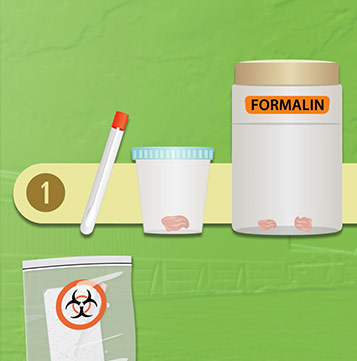 Frame from a video about packaging samples showing containers and transport medium labeled Formalin