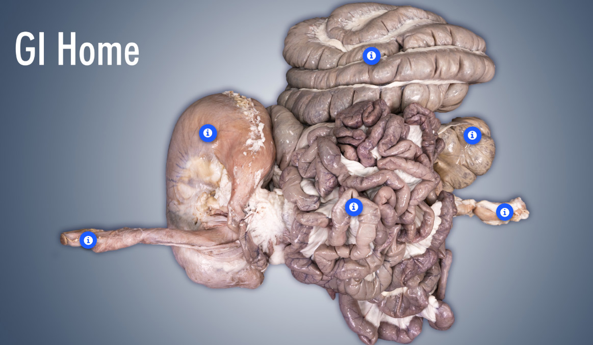 GI home screen showing entire GI tract with buttons