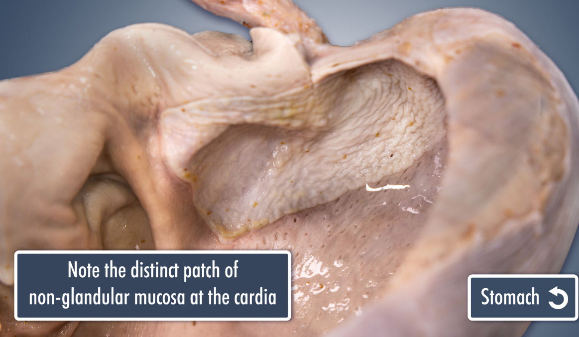 close up screen showing specific characteristics of the organ