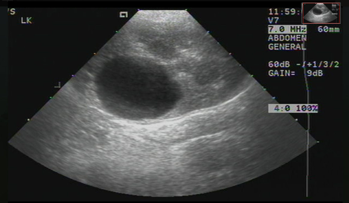 radiograph screen