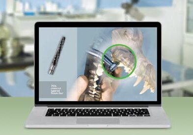 Laptop showing tooth extraction video
